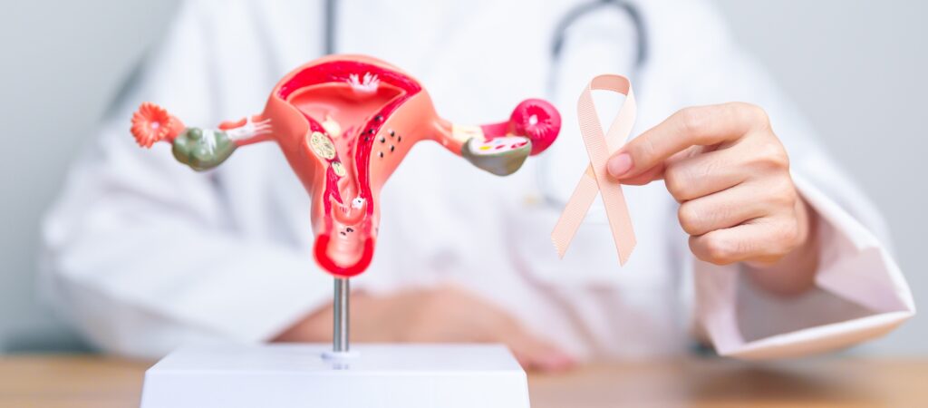 Doctor holding Peach ribbon with Uterus and Ovaries model for September Uterine Cancer Awareness